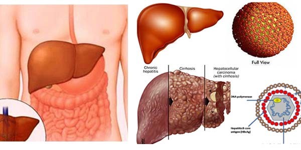 Viêm gan B có đi xuất khẩu lao động Hàn Quốc được không?